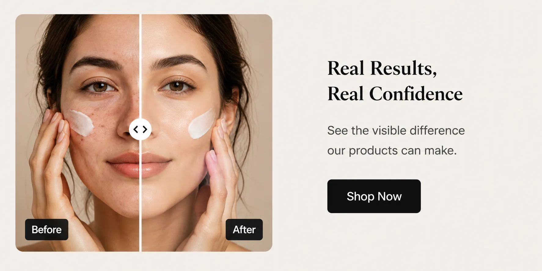 Prestige Shopify Theme Demo before and after section for skincare